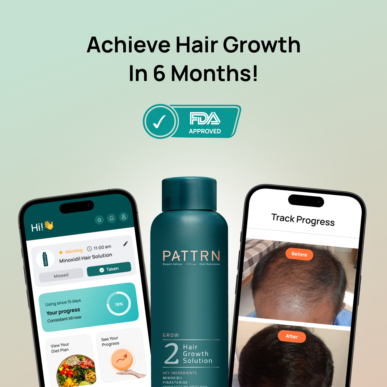 Minoxidil 5% + Hair Growth App