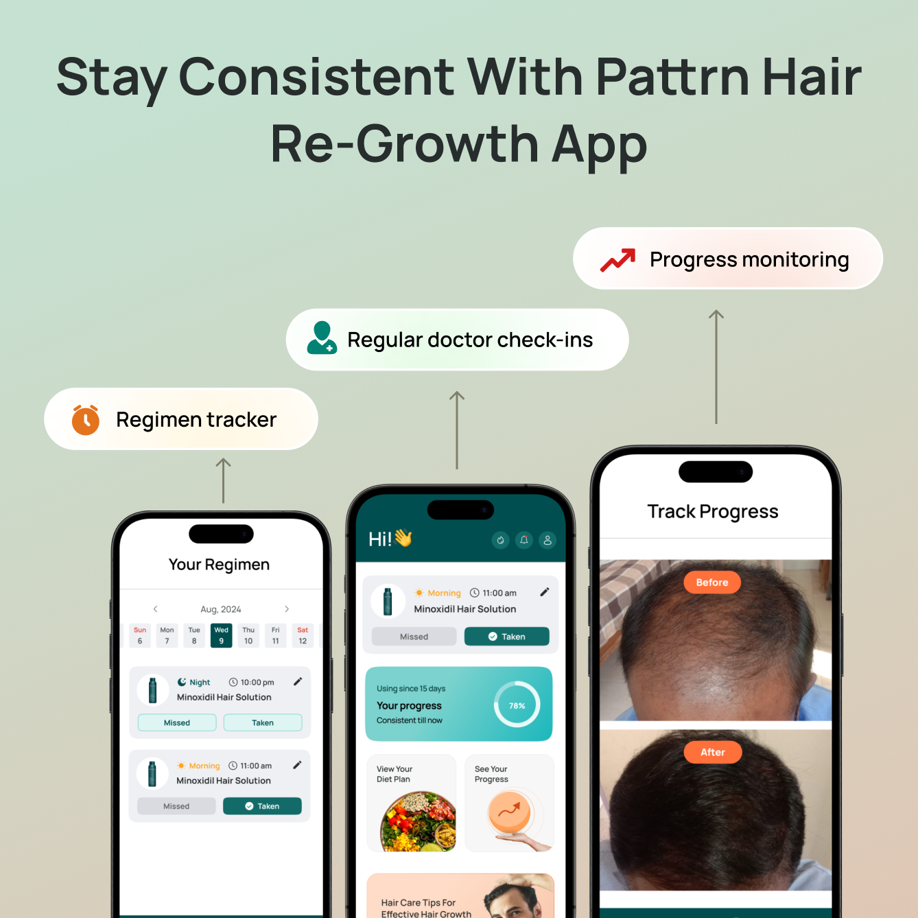 Minoxidil 5% + Hair Growth App